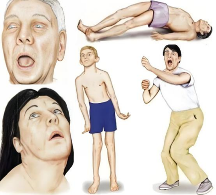 image.png image.png