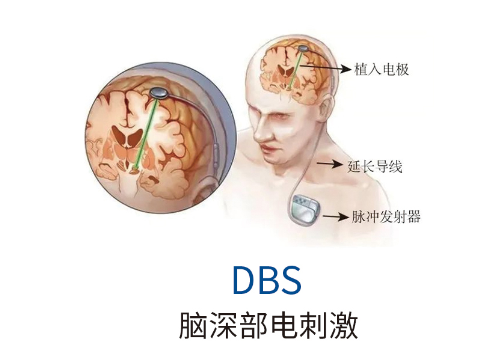 727bb380eb9bf4fa9eb005c949e7b2bb.png 727bb380eb9bf4fa9eb005c949e7b2bb.png