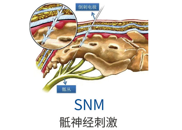 3c948dda67fa617a1616104cb54ac141.png 3c948dda67fa617a1616104cb54ac141.png
